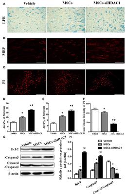 Corrigendum: HDAC1 Silence Promotes Neuroprotective Effects of Human Umbilical Cord-Derived Mesenchymal Stem Cells in a Mouse Model of Traumatic Brain Injury via PI3K/AKT Pathway